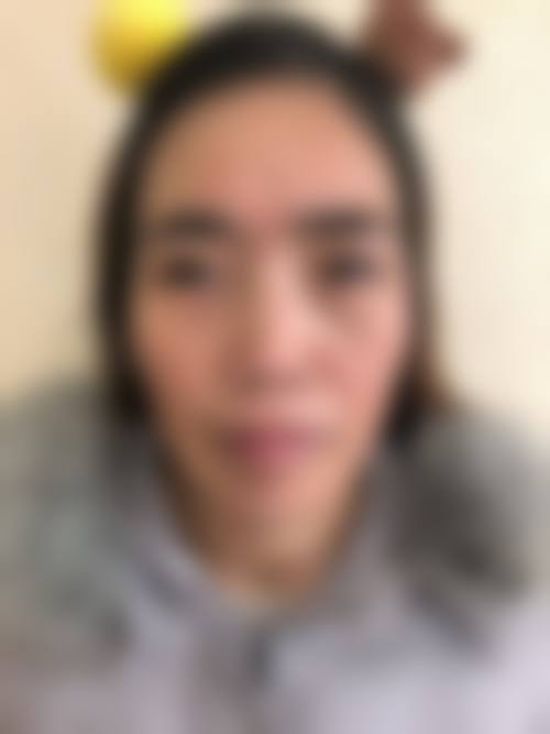 八、广州嘉悦整形医疗美容真实的患者评价