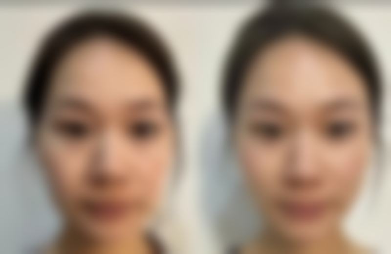 六、陈焕雄真实的患者评价