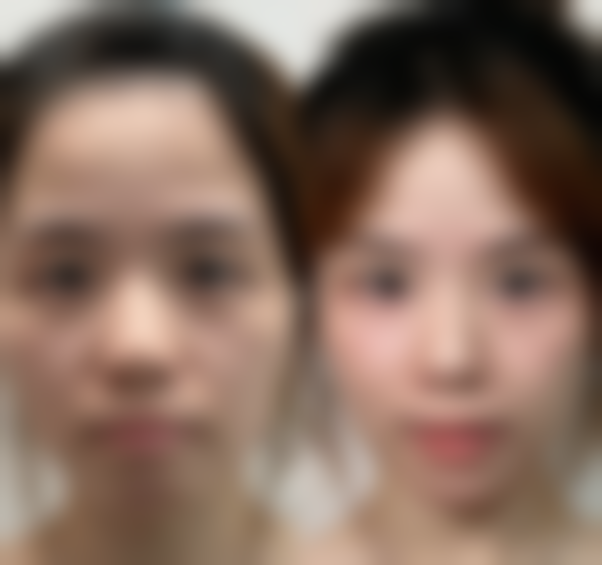 八、韩国Orbit皮肤科医院真实的患者评价