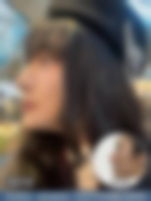四、深圳丽格植发特色项目