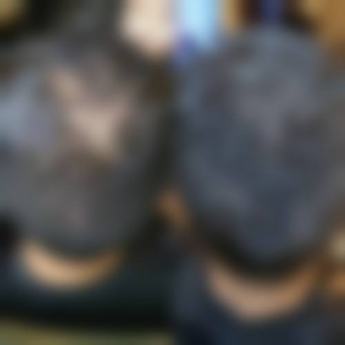 五、深圳丽格植发价格表