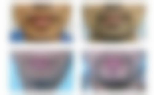 七、深圳丽格植发预约方式