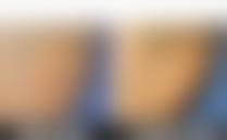 二、深圳丽格植发怎么样？