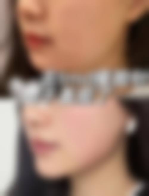 八、衡阳魅丽嘉医疗美容诊所真实的患者评价
