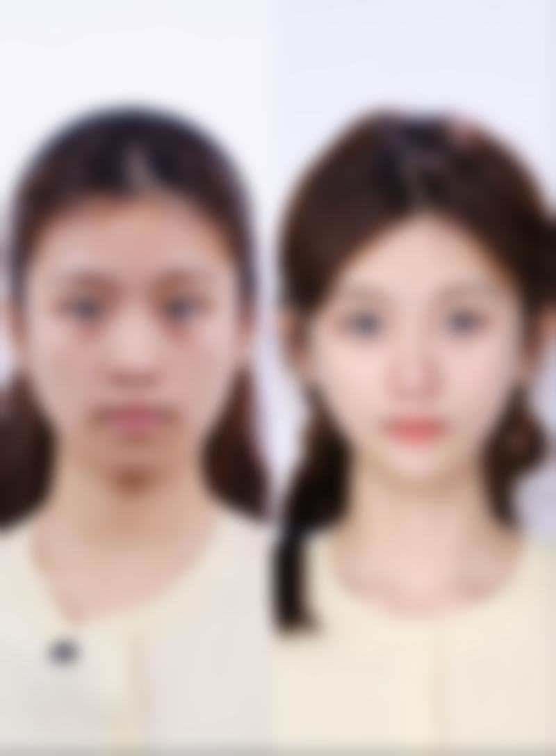 五、海口依琳医疗美容门诊部价格表