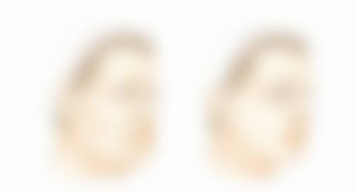 一、假体隆胸后侧身睡觉时间的大致范围
