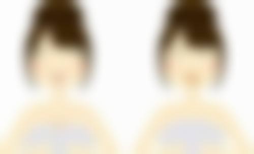 二、激光治疗去眼袋