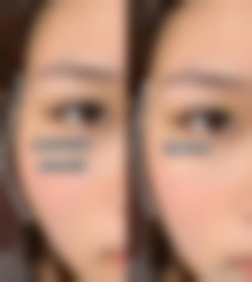 九、北京医 科整形美容门诊部真实的患者评价