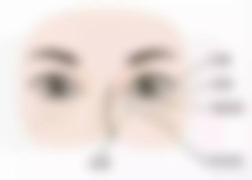 五、打瘦脸针的风险及应对措施