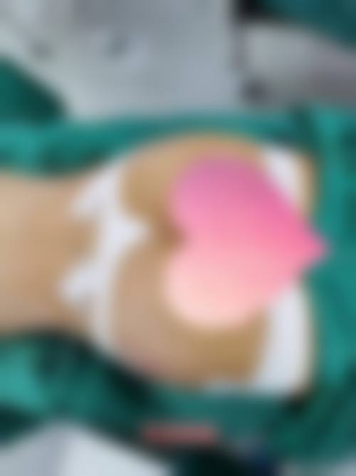 七、宿州天使医疗美容医院预约方式