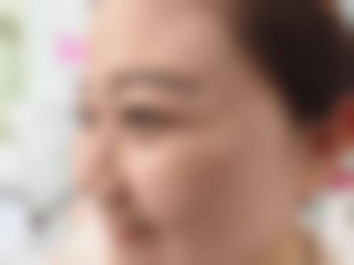 五、郑州优恩医疗美容医院(原悦美)价格表