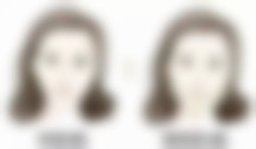三、疤痕性皮肤伤疤怎么去掉之物理治疗