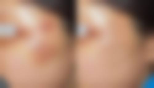 六、朱吉菊真实的患者评价