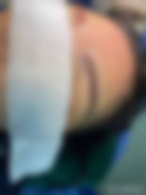 八、vsline江南店真实的患者评价