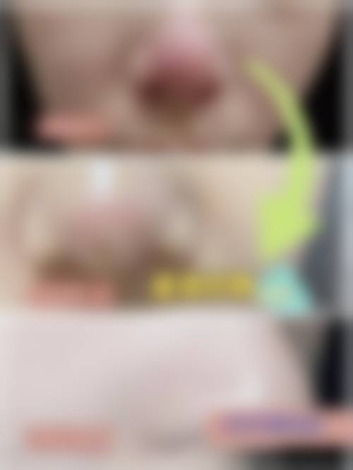 七、台安晨美整形医院预约方式