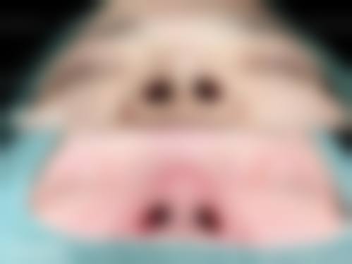 八、台安晨美整形医院真实的患者评价