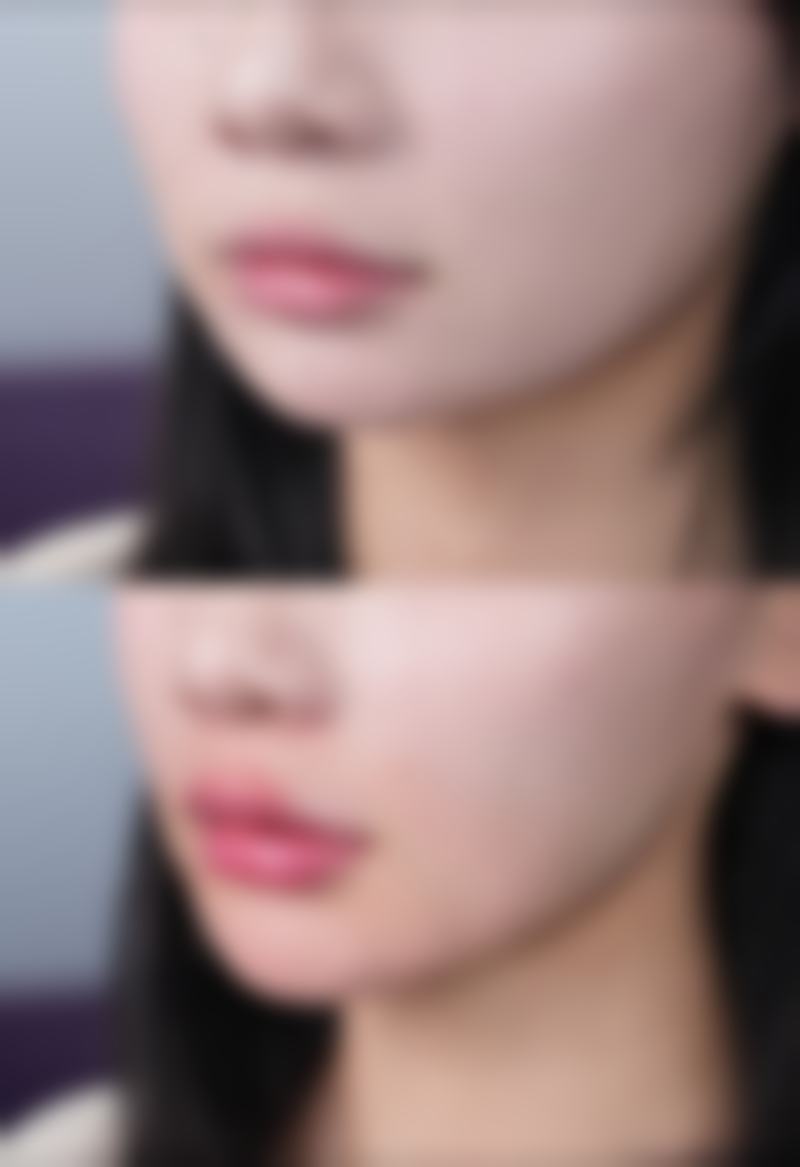 三、有什么按摩手法可以缓解眼袋之眼周轻抚