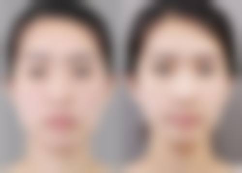二、莱芜尚美整形医疗美容医院怎么样？