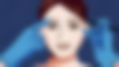 五、肿泡眼割双眼皮的术后护理