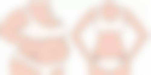 {肿泡眼割什么样的双眼皮好看？扇形与平扇形解析及效果图片大揭秘