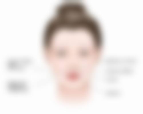 八、术后怎样去掉疤痕之预防疤痕疙瘩