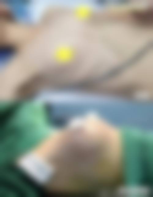二、珠海科美医疗美容整形医院怎么样？