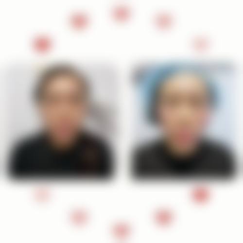 九、焦作迦美医疗美容诊所真实的患者评价