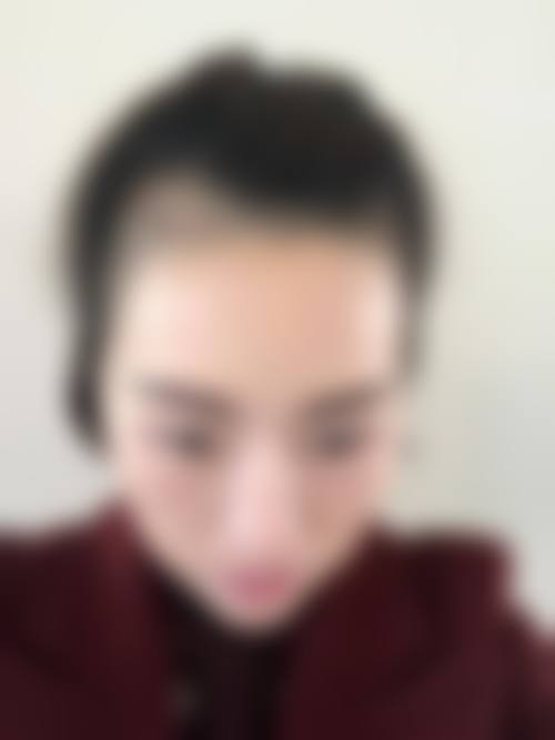 五、深圳丽格植发专科诊所价格表