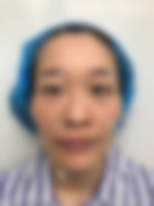 九、珠海科美医疗美容整形医院真实的患者评价