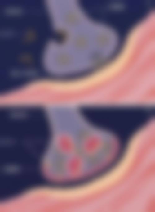 一、风格适配性之单眼皮和双眼皮吊顶哪个好看