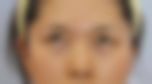 四、南充君子丽人整形医疗美容医院特色项目