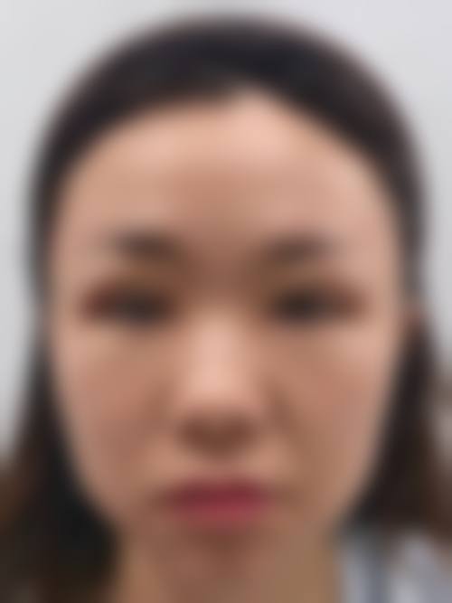 二、泉州惠安新颜皮肤专科门诊部怎么样？