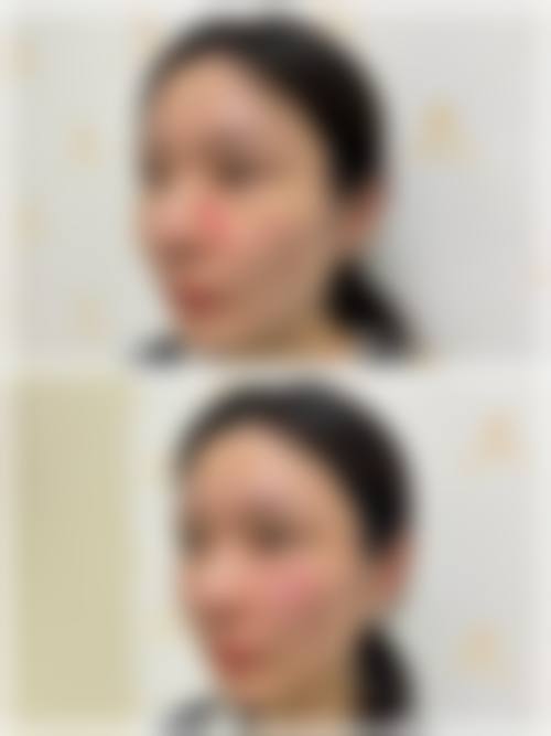 八、泉州惠安新颜皮肤专科门诊部真实的患者评价