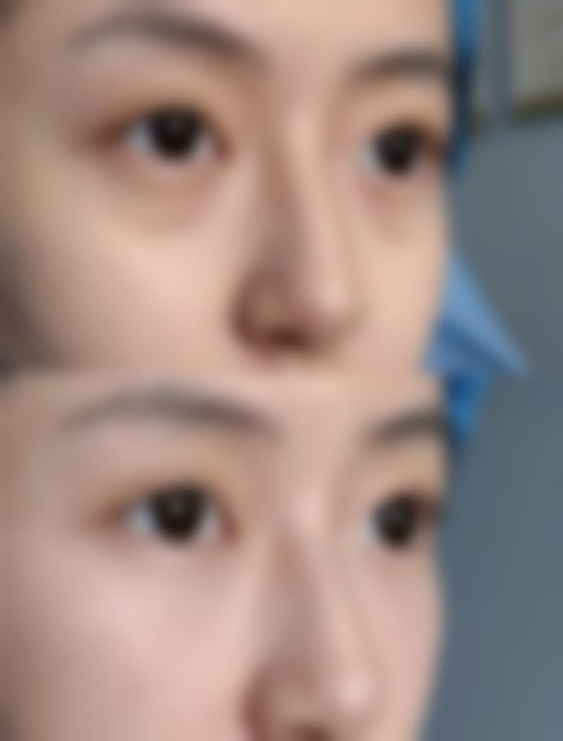 三、赵晓兰技术优势