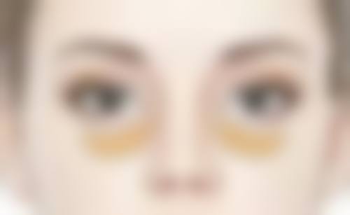{额头有疤痕怎么消除最快？药物、激光、手术等方法为你揭秘有效方案 