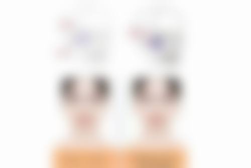 二、超体隆鼻的优点