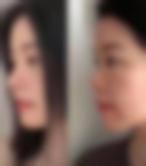 九、淄博美联臣医疗美容医院真实的患者评价