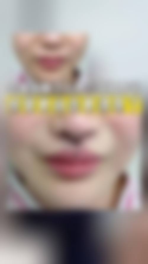 二、随州双美禾美整形医院怎么样?