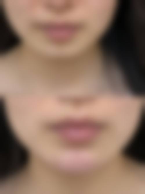二、费滕擅长项目