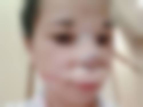 八、面部抽脂消肿异常情况的处理