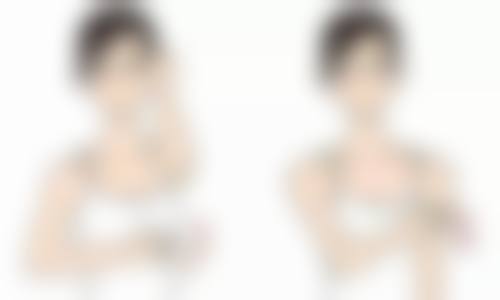 七、割双眼皮出血多吗之不同手术方式的出血差异