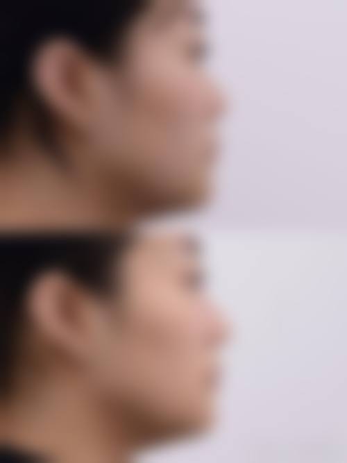 四、无锡凯宜医院整形美容科特色项目