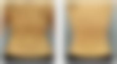 五、温州眼谷超级眼视光医院医疗美容科价格表