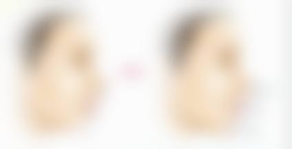三、南京新帝瑞拉医疗美容诊疗项目有哪些？