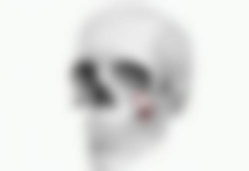 二、做的双眼皮松弛的处理方法