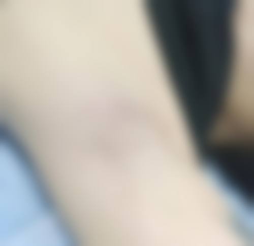 二、广州后勤医院激光整形美容中 心怎么样?