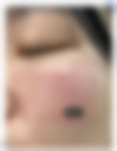 六、苏乾泰真实的患者评价