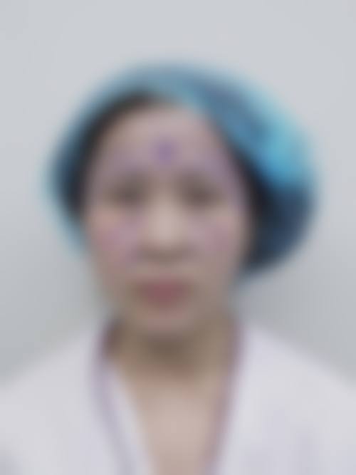 五、通化晶晶医学整形美容院价格表