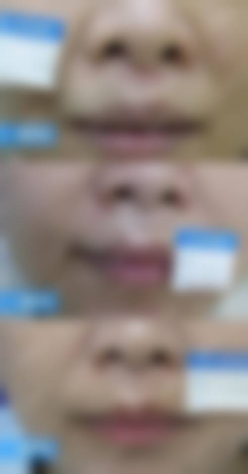 八、北京炫美医疗美容真实的患者评价
