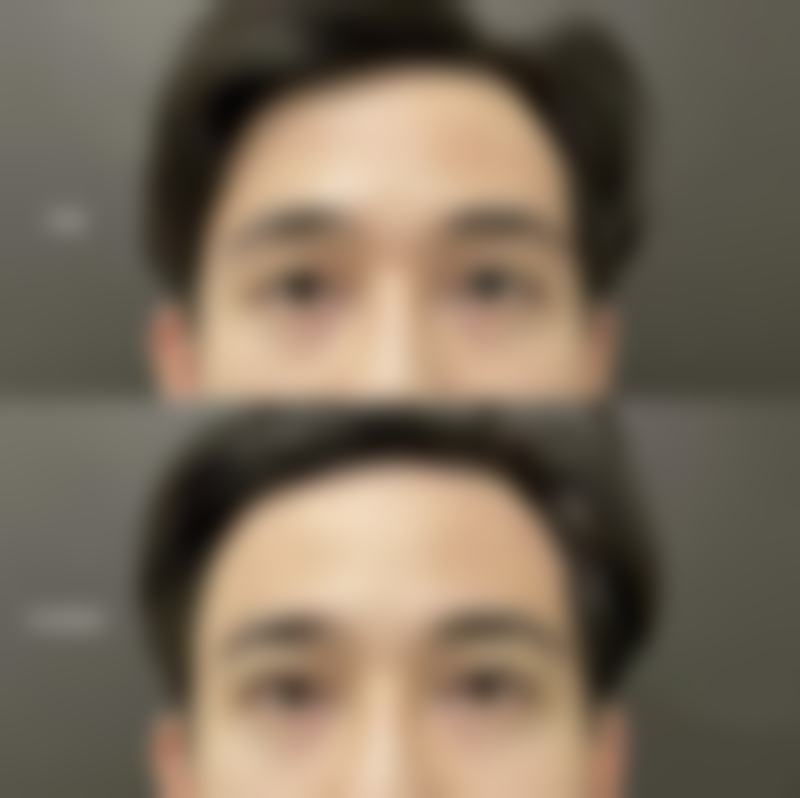 三、蜂蜜和蛋清能去眼袋吗:使用方法及成效